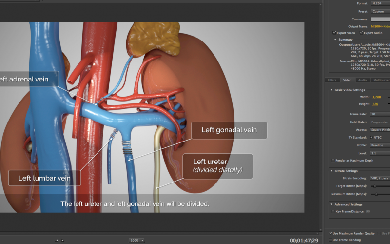 Video Editing Tips for Surgeons, Pt.1: Resolution Video Editing Tips for Surgeons, Pt.1: Resolution